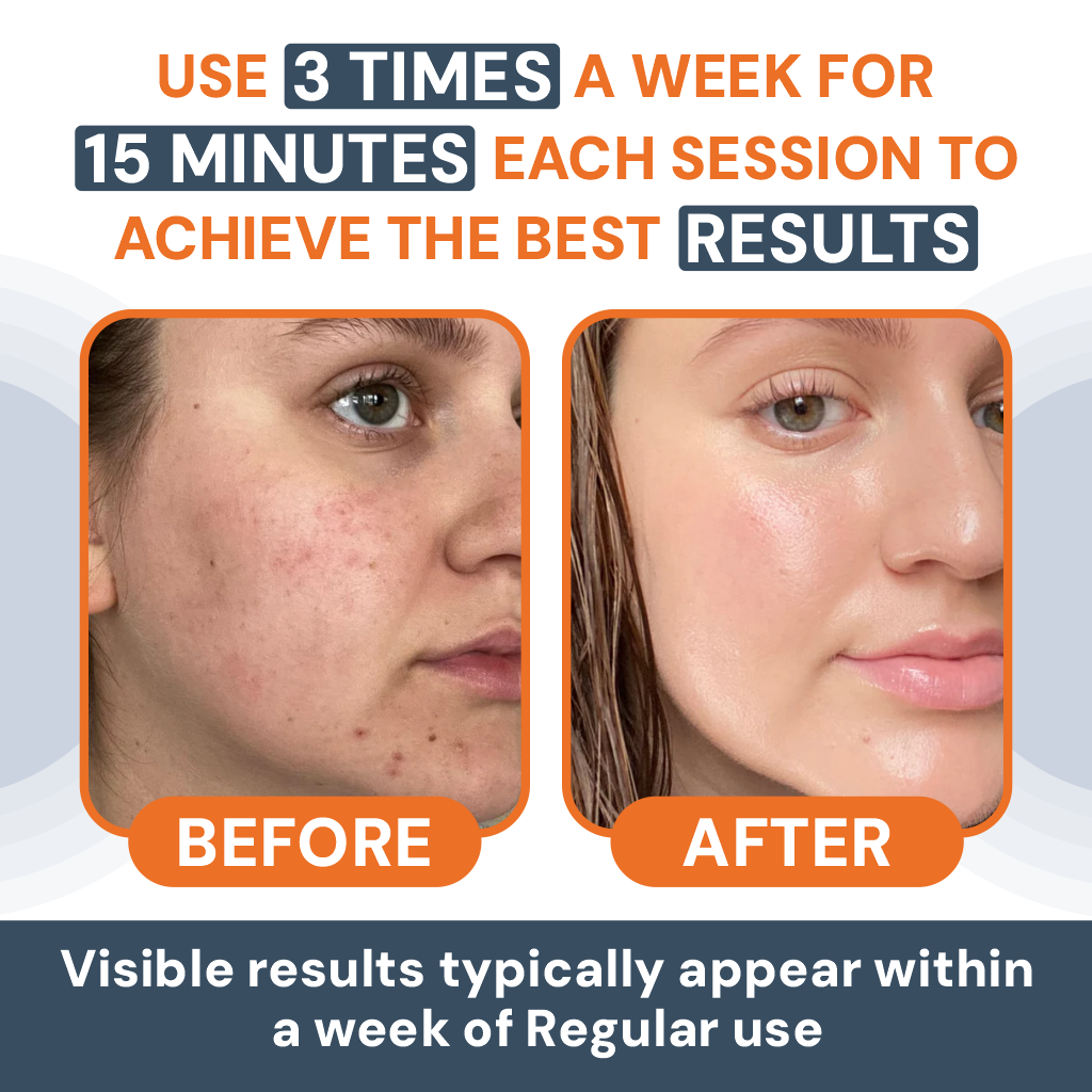 7-in-1 LED Facial Sculptor