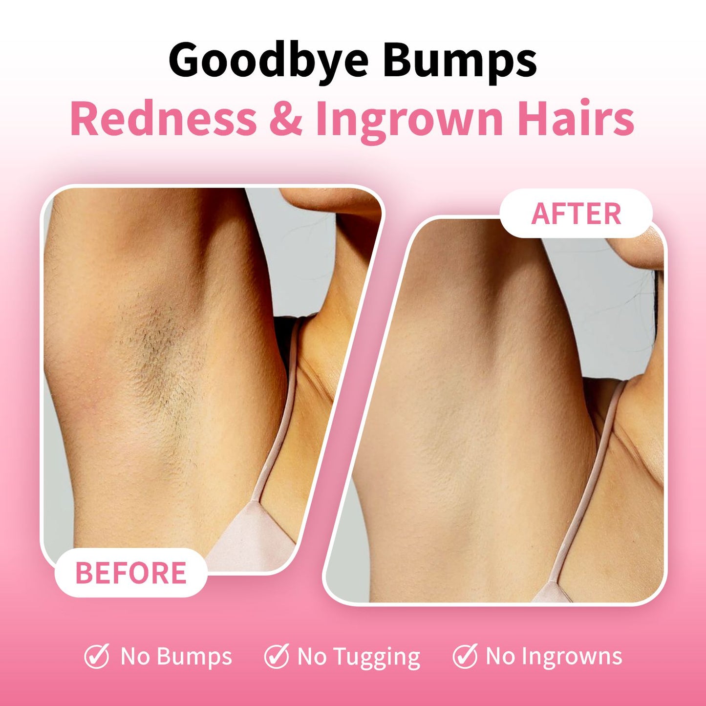 Women's Single Blade Safety Razor - Metal Reusable Razor for Sensitive Skin & Legs