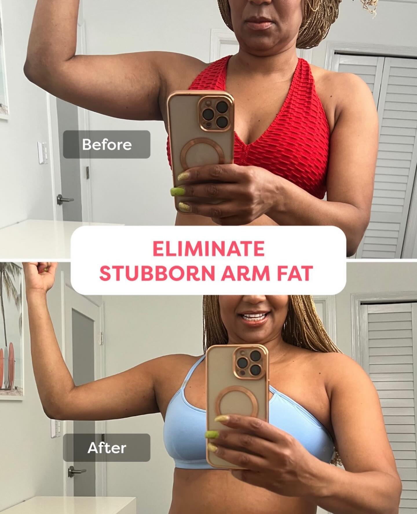 AuraSculpt™ | 3 in 1 Face & Body Sculpting Device